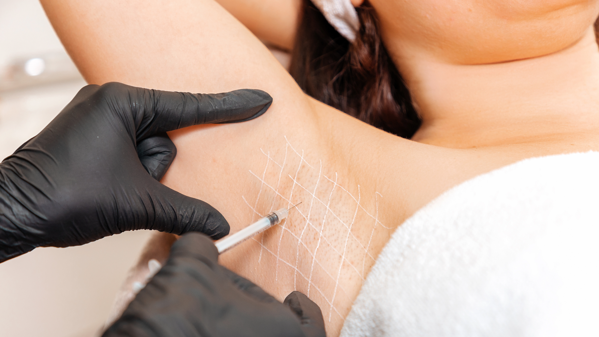 Clinician wearing black gloves marks a grid on the neck to guide injections, syringe ready to use (close-up).